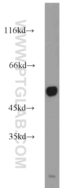 mouse brain tissue were subjected to SDS PAGE followed by western blot with Tubulin-beta Antibody 10068-1-AP Tubulin-beta western blot WB 10068-1-AP Tubulin-beta Antibody MC1R; TUBB4; beta-4