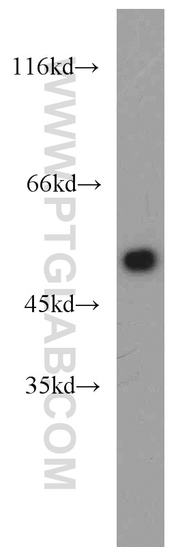 HeLa cells were subjected to SDS PAGE followed by western blot with Tubulin-beta Antibody 10068-1-AP Tubulin-beta western blot WB 10068-1-AP Tubulin-beta Antibody MC1R; TUBB4; beta-4