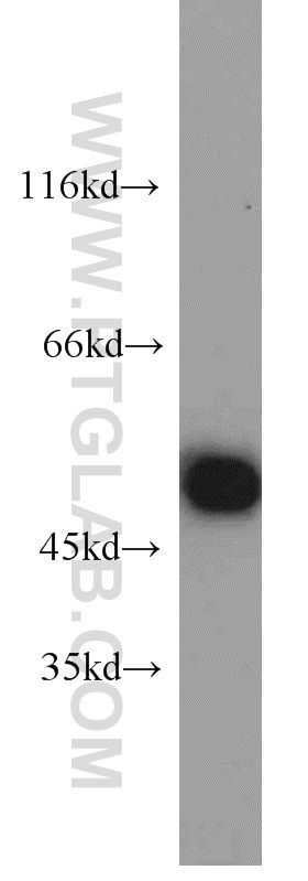 HEK-293 cells were subjected to SDS PAGE followed by western blot with Tubulin-beta Antibody 10068-1-AP Tubulin-beta western blot WB 10068-1-AP Tubulin-beta Antibody MC1R; TUBB4; beta-4