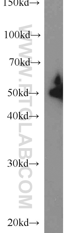 HeLa cells were subjected to SDS PAGE followed by western blot with Tubulin-beta Antibody 10068-1-AP Tubulin-beta western blot WB 10068-1-AP Tubulin-beta Antibody MC1R; TUBB4; beta-4