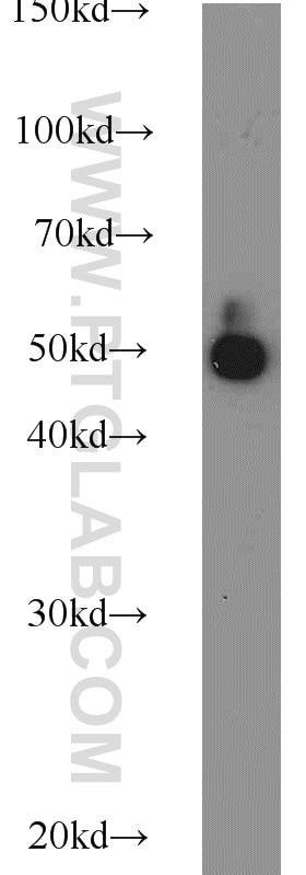 HeLa cells were subjected to SDS PAGE followed by western blot with Tubulin-beta Antibody 10068-1-AP Tubulin-beta western blot WB 10068-1-AP Tubulin-beta Antibody MC1R; TUBB4; beta-4