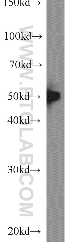 HeLa cells were subjected to SDS PAGE followed by western blot with Tubulin-beta Antibody 10068-1-AP Tubulin-beta western blot WB 10068-1-AP Tubulin-beta Antibody MC1R; TUBB4; beta-4