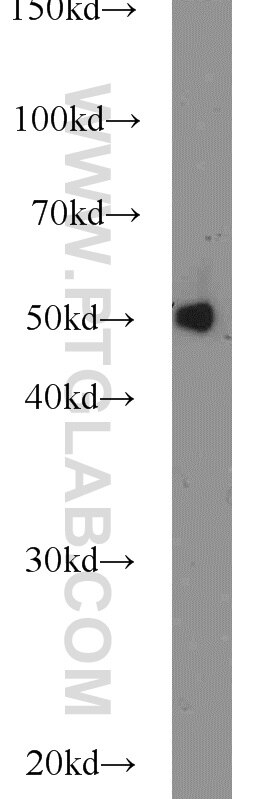 HeLa cells were subjected to SDS PAGE followed by western blot with Tubulin-beta Antibody 10068-1-AP Tubulin-beta western blot WB 10068-1-AP Tubulin-beta Antibody MC1R; TUBB4; beta-4