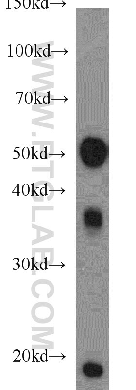 rat brain tissue were subjected to SDS PAGE followed by western blot with Tubulin-beta Antibody 10068-1-AP Tubulin-beta western blot WB 10068-1-AP Tubulin-beta Antibody MC1R; TUBB4; beta-4