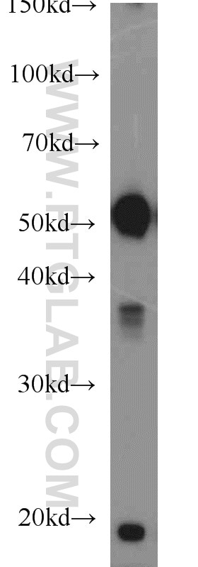 rat brain tissue were subjected to SDS PAGE followed by western blot with Tubulin-beta Antibody 10068-1-AP Tubulin-beta western blot WB 10068-1-AP Tubulin-beta Antibody MC1R; TUBB4; beta-4