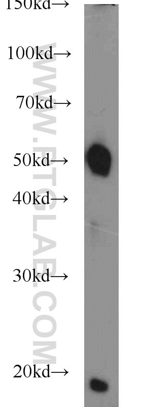 rat brain tissue were subjected to SDS PAGE followed by western blot with Tubulin-beta Antibody 10068-1-AP Tubulin-beta western blot WB 10068-1-AP Tubulin-beta Antibody MC1R; TUBB4; beta-4