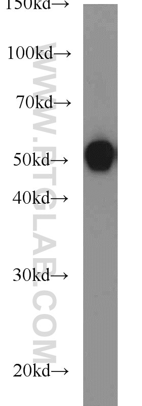Neuro-2a cells were subjected to SDS PAGE followed by western blot with Tubulin-beta Antibody 10068-1-AP Tubulin-beta western blot WB 10068-1-AP Tubulin-beta Antibody MC1R; TUBB4; beta-4