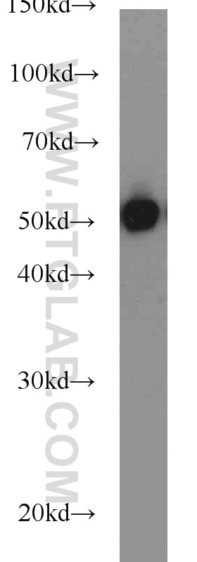 Neuro-2a cells were subjected to SDS PAGE followed by western blot with Tubulin-beta Antibody 10068-1-AP Tubulin-beta western blot WB 10068-1-AP Tubulin-beta Antibody MC1R; TUBB4; beta-4
