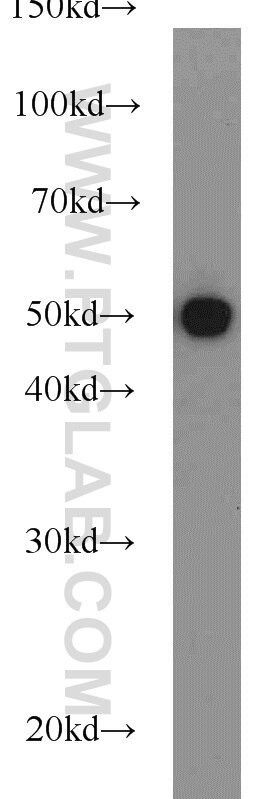 Neuro-2a cells were subjected to SDS PAGE followed by western blot with Tubulin-beta Antibody 10068-1-AP Tubulin-beta western blot WB 10068-1-AP Tubulin-beta Antibody MC1R; TUBB4; beta-4
