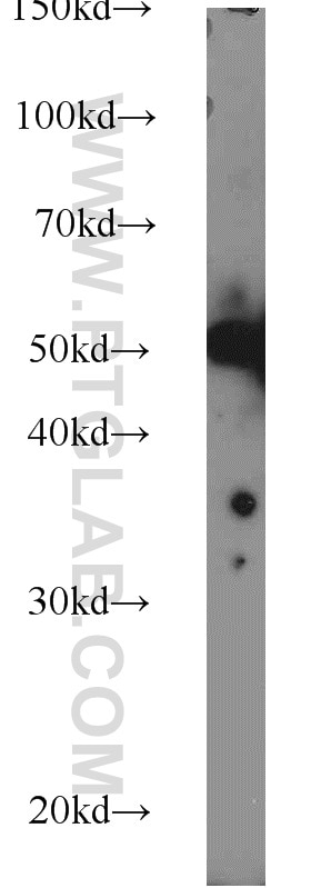 Neuro-2a cells were subjected to SDS PAGE followed by western blot with Tubulin-beta Antibody 10068-1-AP Tubulin-beta western blot WB 10068-1-AP Tubulin-beta Antibody MC1R; TUBB4; beta-4