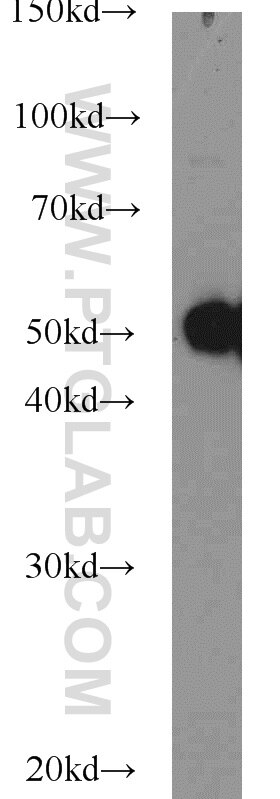 mouse brain tissue were subjected to SDS PAGE followed by western blot with Tubulin-beta Antibody 10068-1-AP Tubulin-beta western blot WB 10068-1-AP Tubulin-beta Antibody MC1R; TUBB4; beta-4