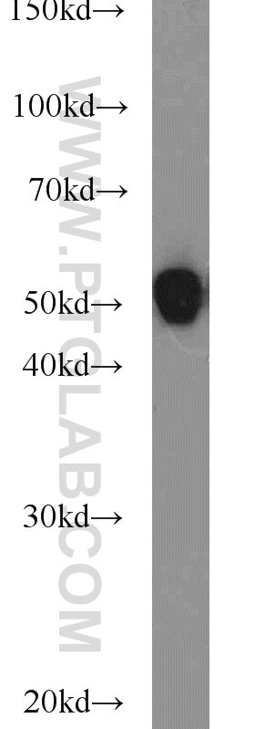 mouse brain tissue were subjected to SDS PAGE followed by western blot with Tubulin-beta Antibody 10068-1-AP Tubulin-beta western blot WB 10068-1-AP Tubulin-beta Antibody MC1R; TUBB4; beta-4