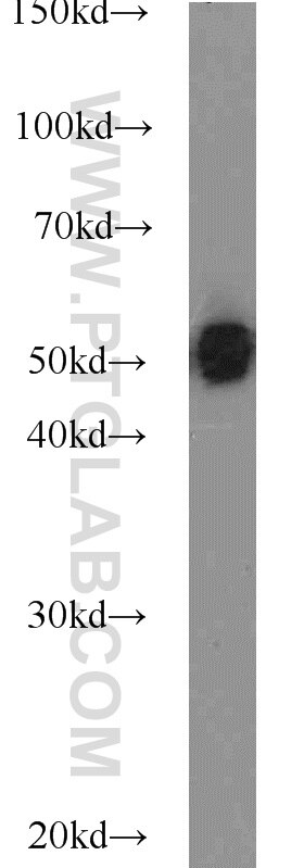 mouse brain tissue were subjected to SDS PAGE followed by western blot with Tubulin-beta Antibody 10068-1-AP Tubulin-beta western blot WB 10068-1-AP Tubulin-beta Antibody MC1R; TUBB4; beta-4