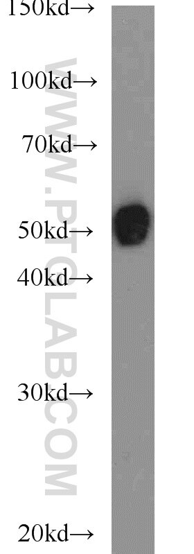 mouse brain tissue were subjected to SDS PAGE followed by western blot with Tubulin-beta Antibody 10068-1-AP Tubulin-beta western blot WB 10068-1-AP Tubulin-beta Antibody MC1R; TUBB4; beta-4