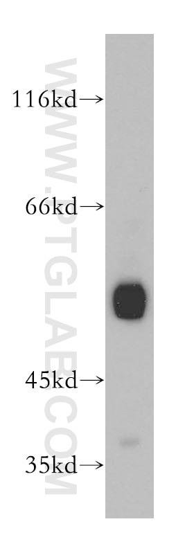 human brain tissue were subjected to SDS PAGE followed by western blot with Tubulin-beta Antibody 10068-1-AP Tubulin-beta western blot WB 10068-1-AP Tubulin-beta Antibody MC1R; TUBB4; beta-4