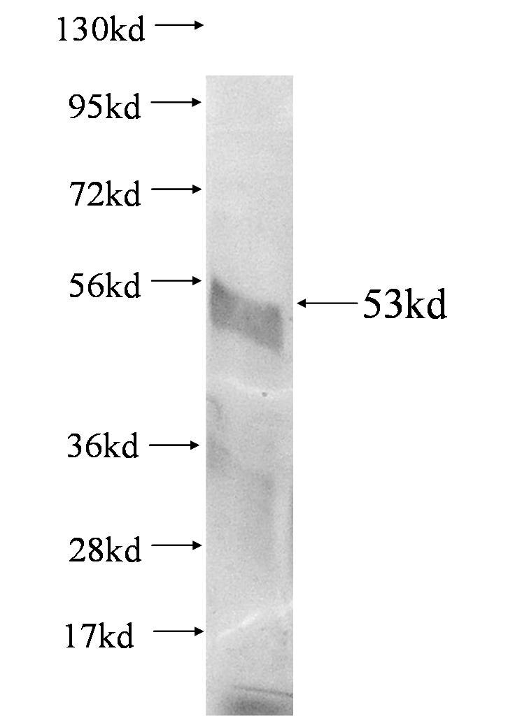 Tubulin-beta fusion protein ag0117 SDS-PAGE