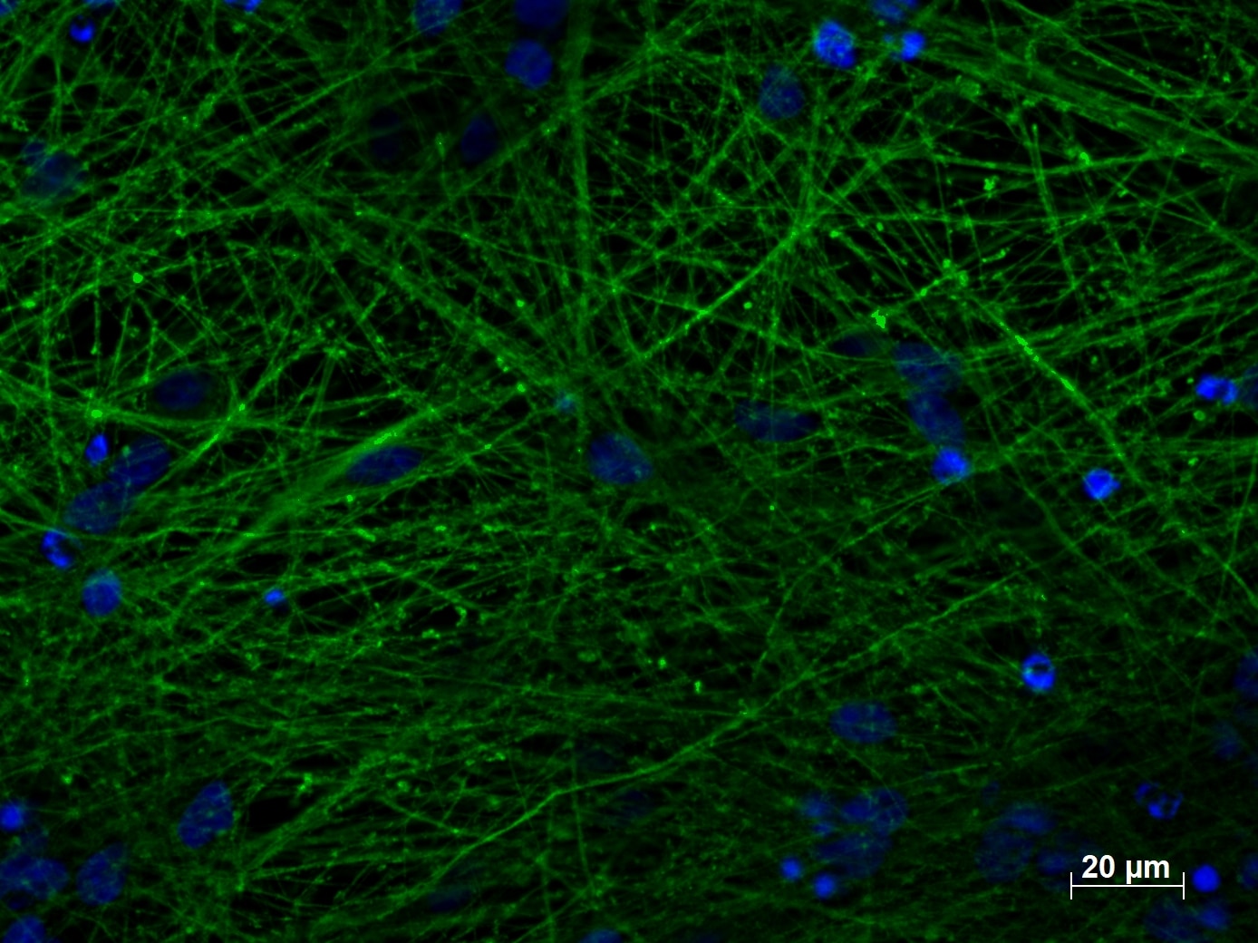 IF staining of MAP2 (17490-1-AP, 1:250 dilution) with 4% PFA fixed control hiPSC derived neuronal cultures (35 days old). (RED MAP2; Blue: DAPI). Provided by BioTalentum Ltd., Hungary