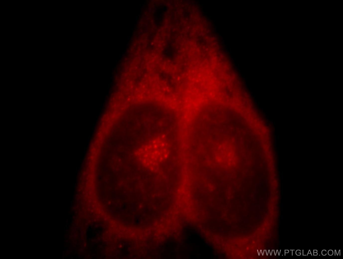 TULP1 Immunofluorescence IF 18971-1-AP TULP1 Antibody RP14; TUBL1
