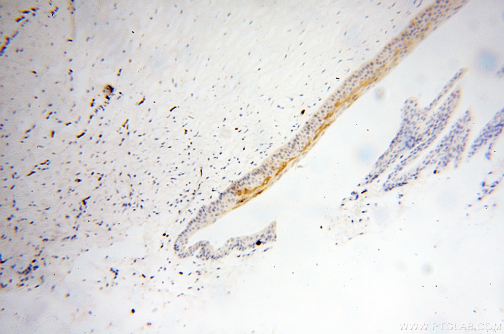 TULP1 IHC Immunohistochemical 18971-1-AP TULP1 Antibody RP14; TUBL1