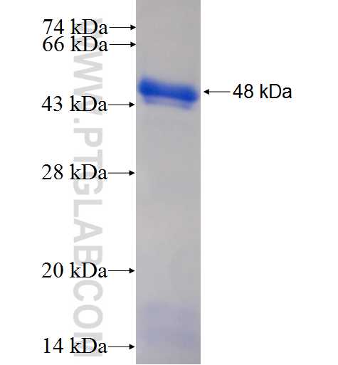 TULP1 fusion protein ag5598 SDS-PAGE