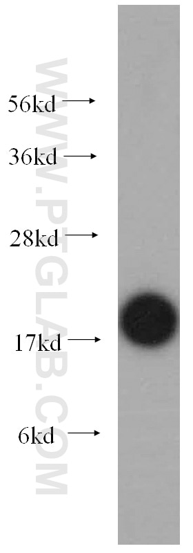 mouse testis tissue were subjected to SDS PAGE followed by western blot with 10070-1-AP(UBC9 Antibody) at dilution of 1:800 UBC9 western blot WB 10070-1-AP UBC9 Antibody C358B7.1; P18; UBC9