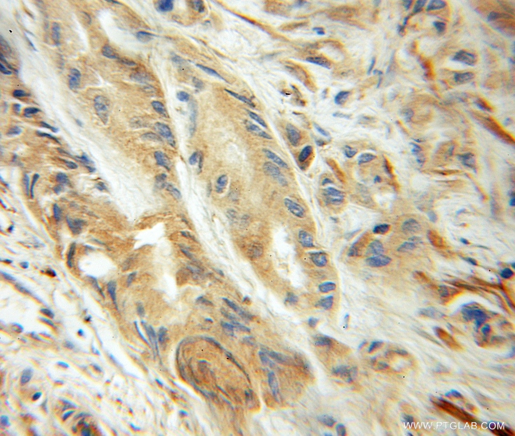 UBC9 IHC Immunohistochemical 51018-2-AP UBC9 Antibody C358B7.1; P18; UBC9