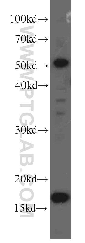 UBC9 western blot WB 60201-1-Ig UBC9 Antibody C358B7.1; P18; UBC9