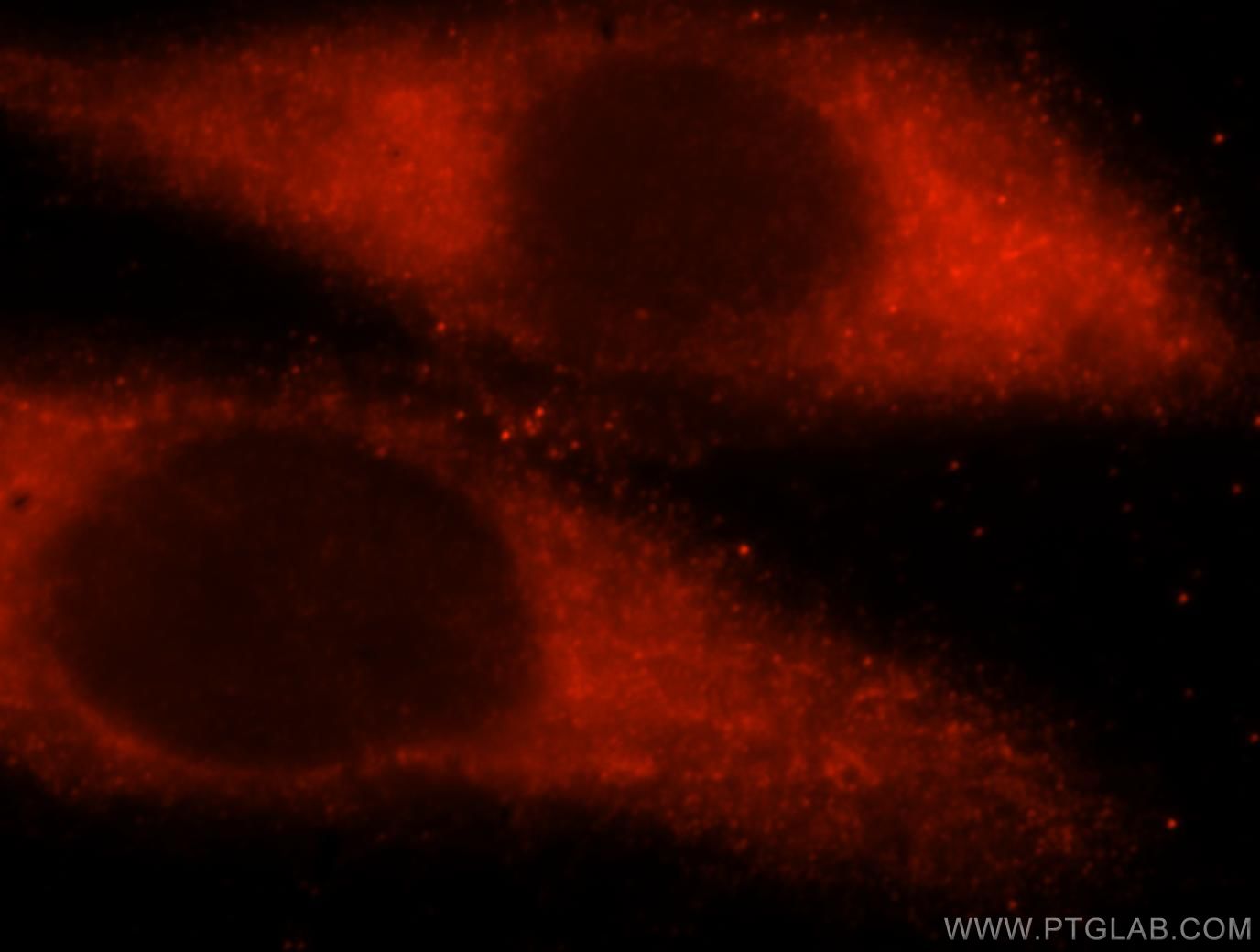 Immunofluorescent analysis of Hela cells, using UBE2L6 antibody 17278-1-AP at 1:25 dilution and Rhodamine-labeled goat anti-rabbit IgG (red). UBE2L6 Immunofluorescence IF 17278-1-AP UBE2L6 Antibody MGC40331; RIG-B; UBCH8