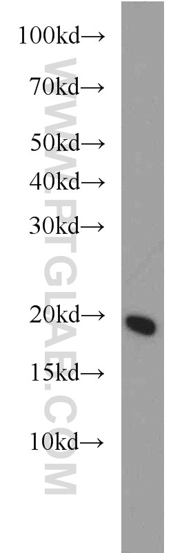 Jurkat cells were subjected to SDS PAGE followed by western blot with 17278-1-AP(UBE2L6 Antibody) at dilution of 1:1000 UBE2L6 western blot WB 17278-1-AP UBE2L6 Antibody MGC40331; RIG-B; UBCH8