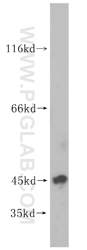 human testis tissue were subjected to SDS PAGE followed by western blot with 16928-1-AP(UBE2Z Antibody) at dilution of 1:1000 UBE2Z western blot WB 16928-1-AP UBE2Z Antibody FLJ13855; HOYS7; USE1