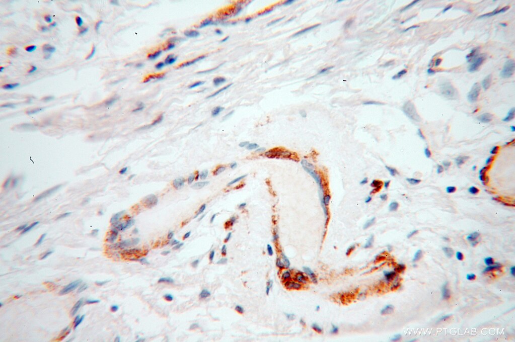 UBL4A IHC Immunohistochemical 14253-1-AP UBL4A Antibody DX254E; DXS254E; G6PD; GDX; UBL4