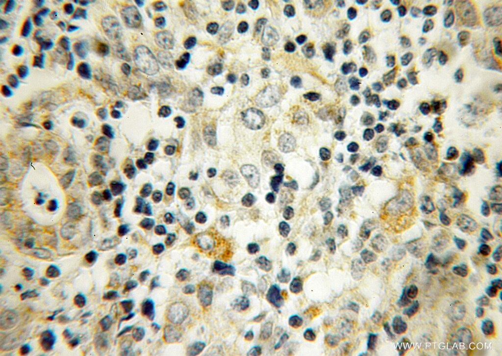 UBTD2 IHC Immunohistochemical 13172-1-AP UBTD2 Antibody DC-UbP; DCUBP; MGC30022