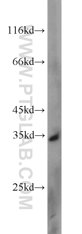 UCK2 western blot WB 10511-1-AP UCK2 Antibody TSA903; UK; UMPK