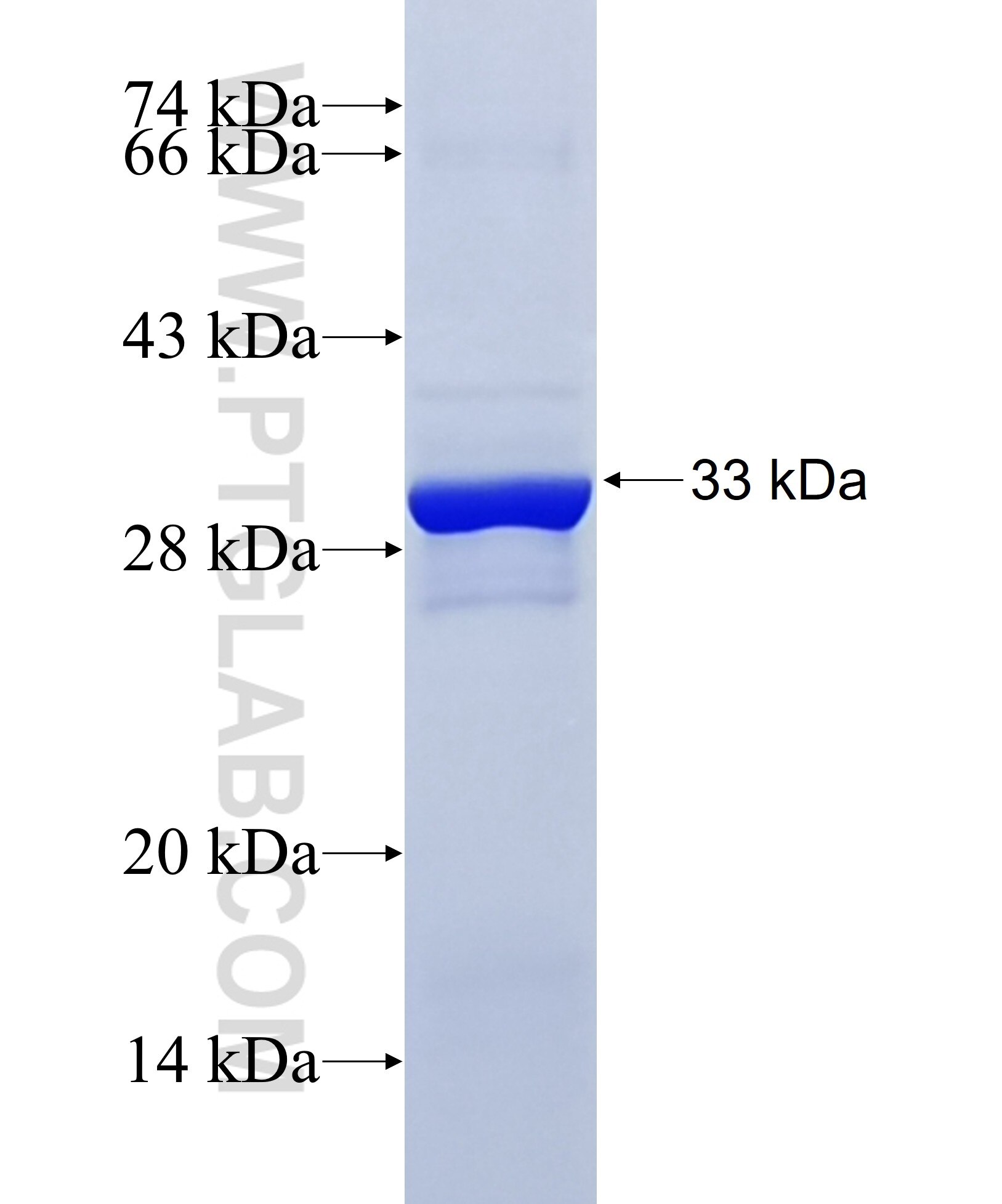  UCP1 fusion protein ag20388 SDS-PAGE