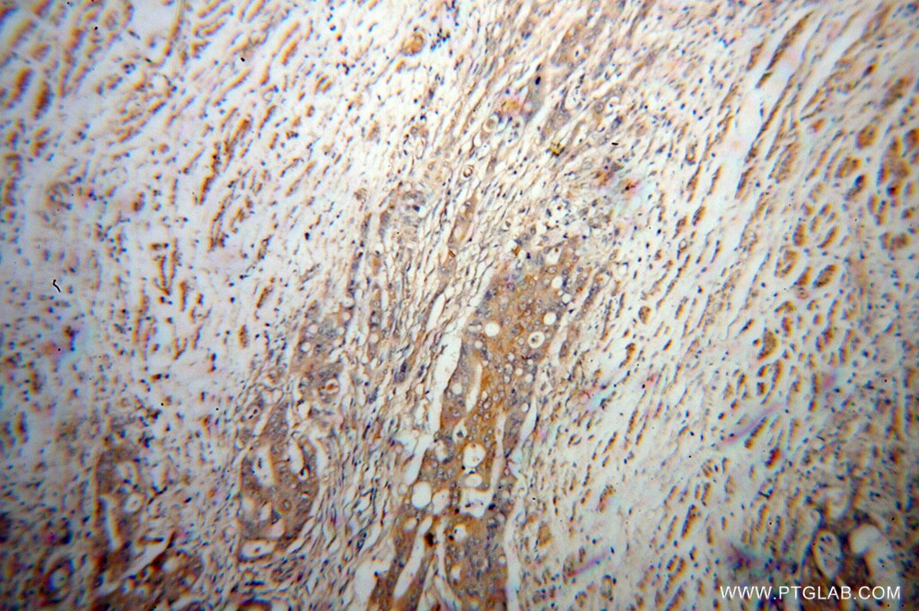 UCP2 IHC Immunohistochemical 11081-1-AP UCP2 Antibody BMIQ4; SLC25A8; UCPH