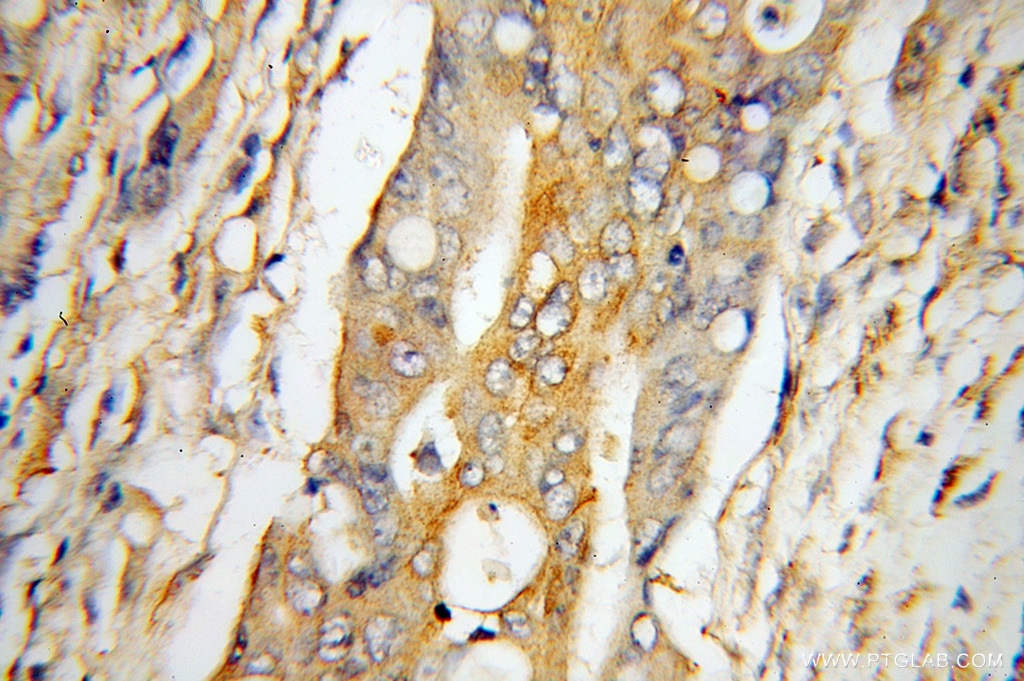 UCP2 IHC Immunohistochemical 11081-1-AP UCP2 Antibody BMIQ4; SLC25A8; UCPH