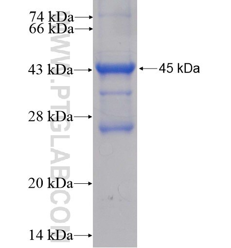 UFC1 fusion protein ag8480 SDS-PAGE