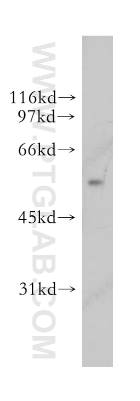 HepG2 cells were subjected to SDS PAGE followed by western blot with 13151-1-AP(UGDH Antibody) at dilution of 1:800 UGDH western blot WB 13151-1-AP UGDH Antibody GDH; UDP-GlcDH; UDPGDH; UGD