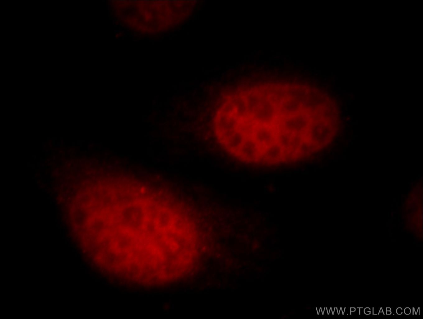 Immunofluorescent analysis of HepG2 cells, using UHRF1 antibody 21402-1-AP at 1:25 dilution and Rhodamine-labeled goat anti-rabbit IgG (red). UHRF1 Immunofluorescence IF 21402-1-AP UHRF1 Antibody FLJ21925; ICBP90; MGC138707; Np95; RNF106; hNP95