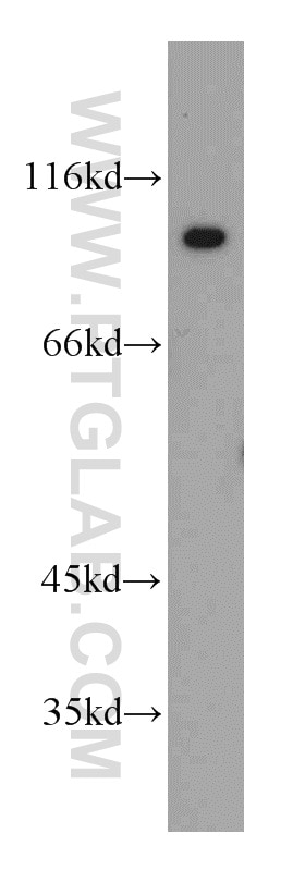 HeLa cells were subjected to SDS PAGE followed by western blot with 21402-1-AP(UHRF1 Antibody) at dilution of 1:1000 UHRF1 western blot WB 21402-1-AP UHRF1 Antibody FLJ21925; ICBP90; MGC138707; Np95; RNF106; hNP95