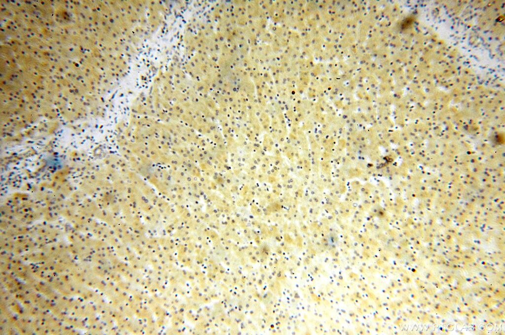 ULBP1 IHC Immunohistochemical 17715-1-AP ULBP1 Antibody RAET1I