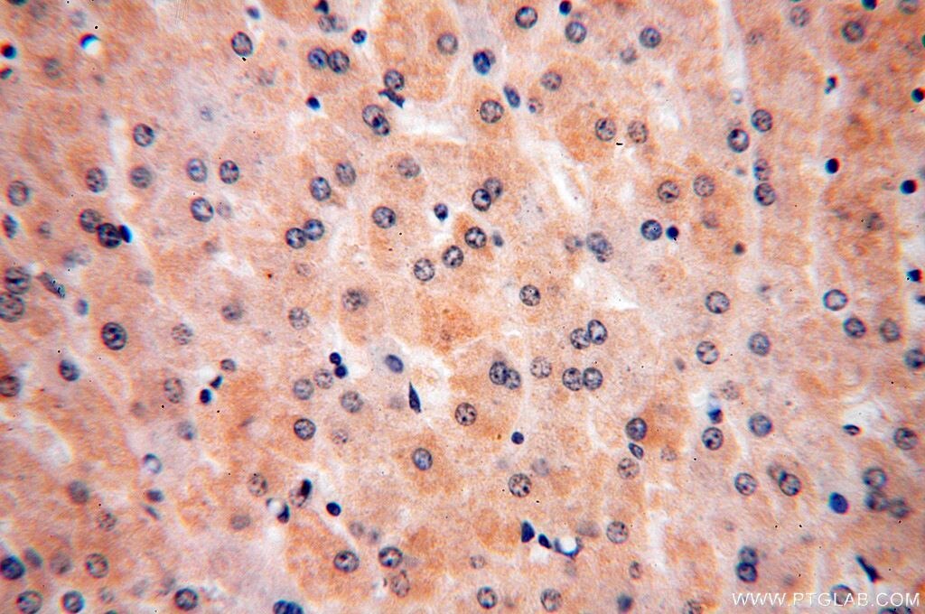 ULBP1 IHC Immunohistochemical 17715-1-AP ULBP1 Antibody RAET1I
