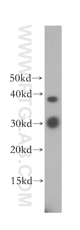 ULBP1 western blot WB 17715-1-AP ULBP1 Antibody RAET1I