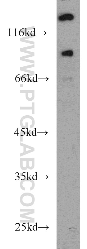 HeLa cells were subjected to SDS PAGE followed by western blot with 22068-1-AP(UNC5A Antibody) at dilution of 1:1000 UNC5A western blot WB 22068-1-AP UNC5A Antibody FLJ16449; KIAA1976; UNC5H1