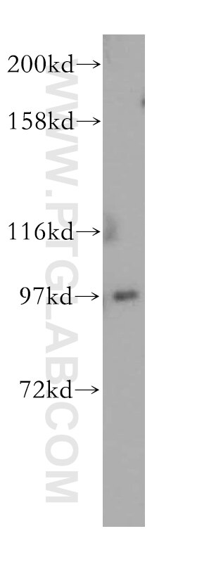 USP13 western blot WB 16840-1-AP USP13 Antibody ISOT3; IsoT-3