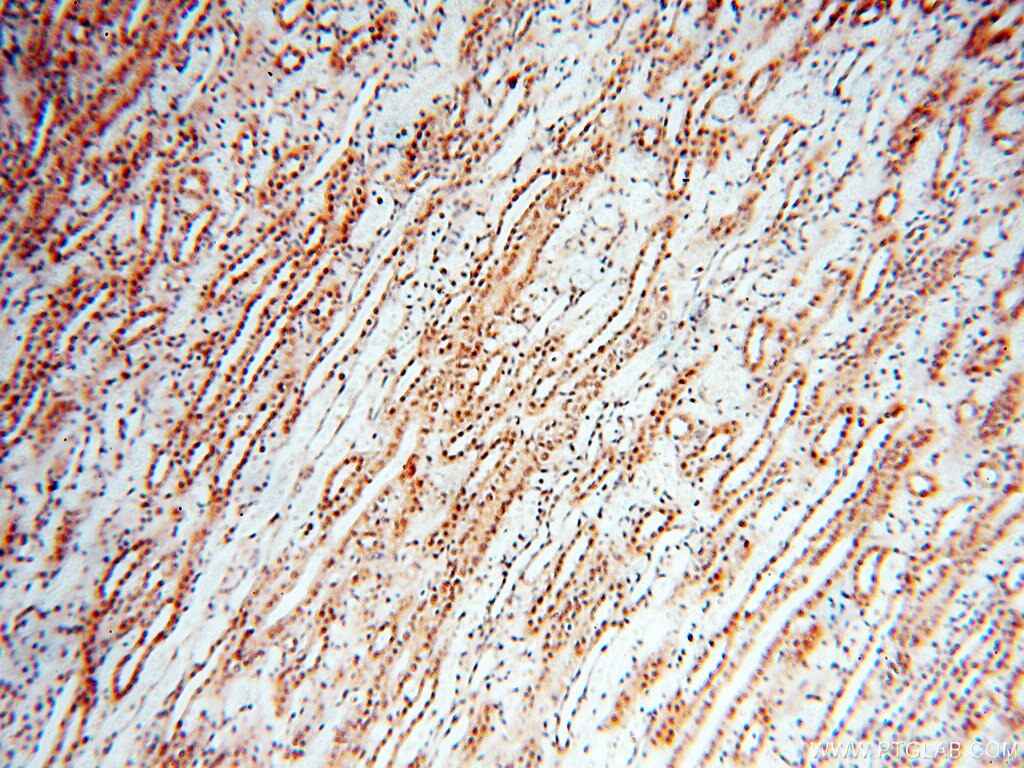 USP16 IHC Immunohistochemical 14055-1-AP USP16 Antibody UBP-M