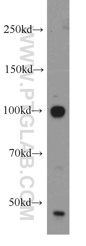 USP16 western blot WB 14055-1-AP USP16 Antibody UBP-M