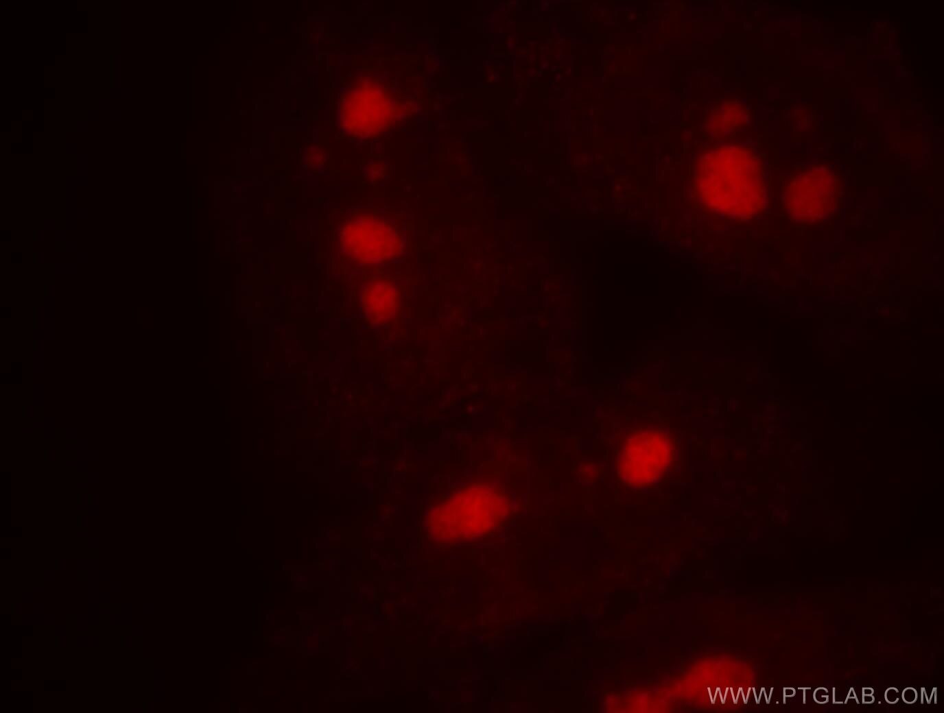 Immunofluorescent analysis of HepG2 cells, using UTP3 antibody 18886-1-AP at 1:50dilution and Rhodamine-labeled goat anti-rabbit IgG (red). UTP3 Immunofluorescence IF 18886-1-AP UTP3 Antibody CRL1; CRLZ1; FLJ23256; SAS10