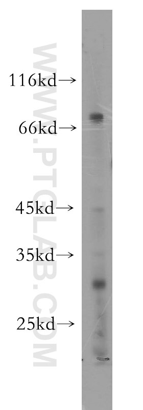 A549 cells were subjected to SDS PAGE followed by western blot with 18886-1-AP(UTP3 Antibody) at dilution of 1:2000 UTP3 western blot WB 18886-1-AP UTP3 Antibody CRL1; CRLZ1; FLJ23256; SAS10
