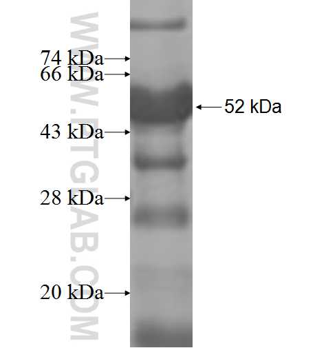 VAC14 fusion protein ag8415 SDS-PAGE